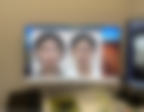 四、对割包皮的疤痕的合理预期