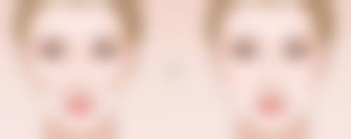 疤痕增生好还是不好？探究成因及应对之策，为你平衡健康与美观需求 