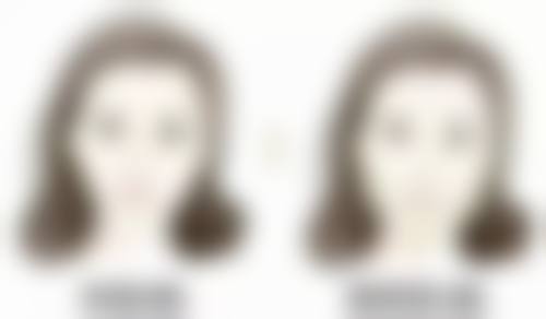 三、鸡蛋可以去眼袋浮肿吗？针对性解决方案