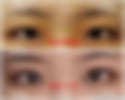 六、南宁农霖整形美容中 心价格表