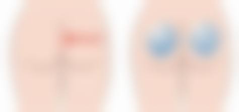 八、荆州中爱整形美容国内外连锁机构预约方式