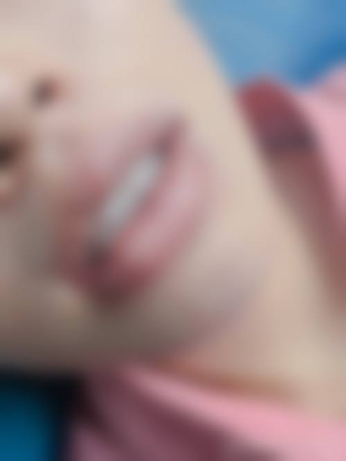 二、新疆乌鲁木齐华美整形医院怎么样？