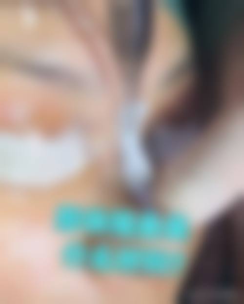 八、新疆乌鲁木齐华美整形医院真实的患者评价