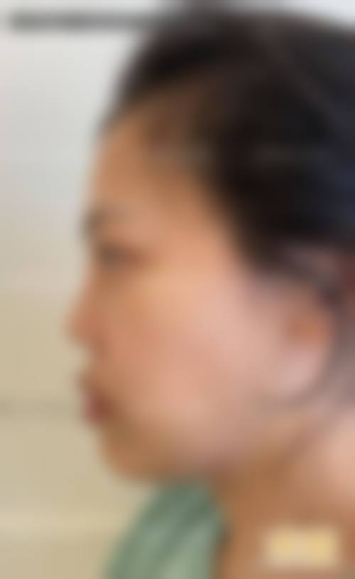 九、荆州中爱整形美容国内外连锁机构真实的患者评价