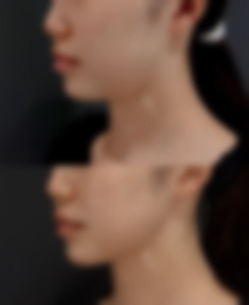 五、生理期拆线的具体注意事项