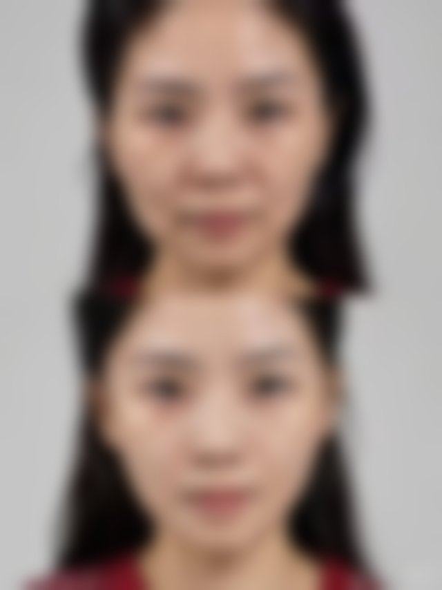 腿上疤痕如何去除？分享小妙招，结合医美与护理让疤痕逐渐不明显 