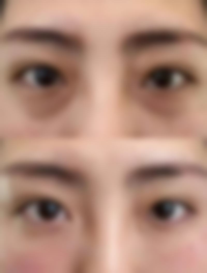 四、哈尔滨艺星美容医院特色项目