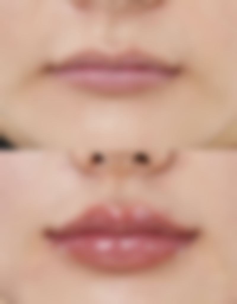 四、日常护理建议