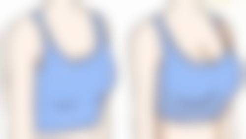 七、结尾：眼袋大多睡觉能下去吗？