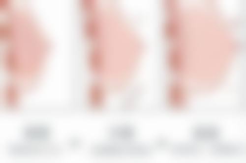 四、宁德华美整形医院特色项目