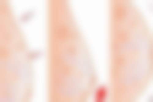 二、宁德华美整形医院怎么样？