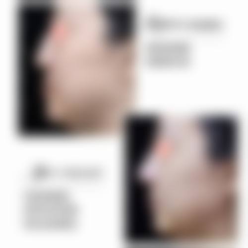 八、保定佰兰医疗美容医院真实的患者评价