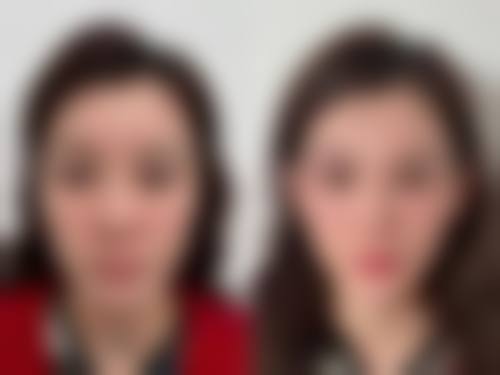 八、昭通爱丽诺整形美容医院真实的患者评价