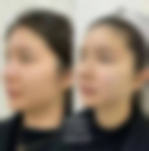 四、保定佰兰医疗美容医院特色项目