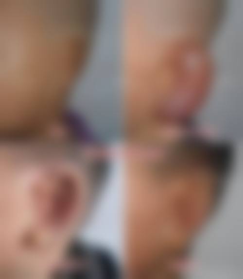 六、广西中医学校前列附属医院仁爱分院价格表