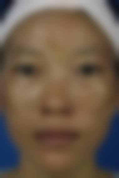 二、昭通爱丽诺整形美容医院怎么样？