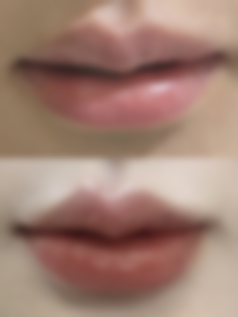 三、林哲秀技术优势