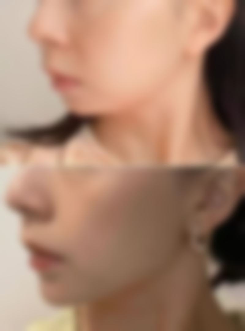 七、徐州市云龙区美玲医学美容医院预约方式