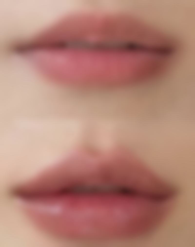 三、影响隆鼻后吸烟时间的因素