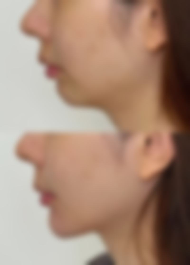 三、保定佰兰医疗美容医院诊疗项目有哪些？