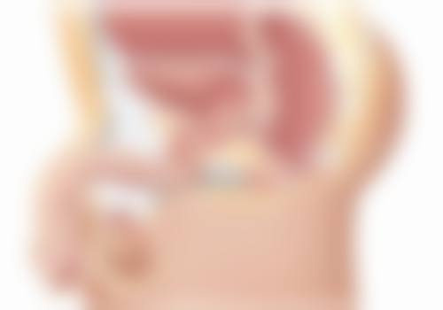 三、可以考虑埋线修复的情况