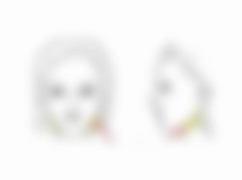 二、做过切开双眼皮再做埋线可能遇到的问题