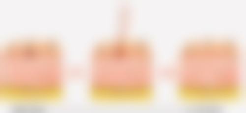 三、多次注射后能否“恒久”瘦脸