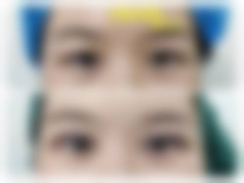 八、韩国拉普莱laforet整形真实的患者评价