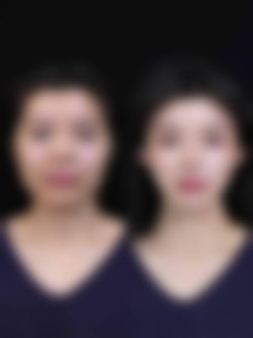 八、长沙开福魅力三和医疗美容门诊部真实的患者评价