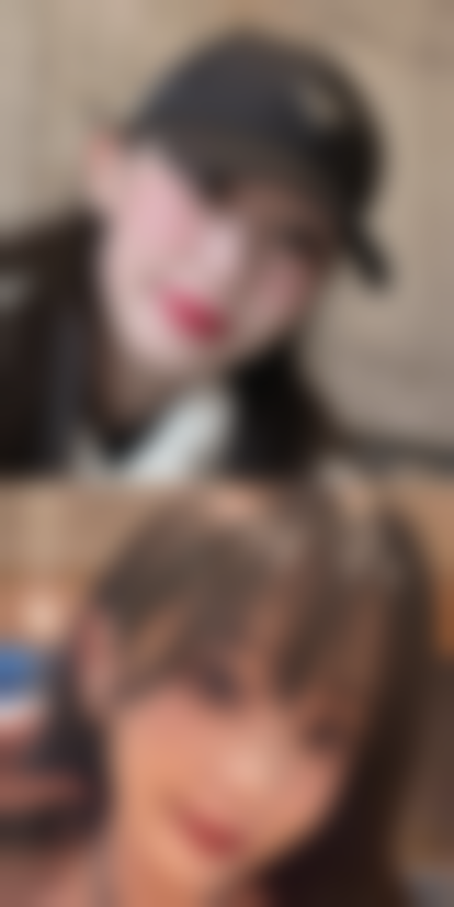 瘦脸针是不是要一直打下去？了解打几次能“永久”瘦脸，答案在这里！ 