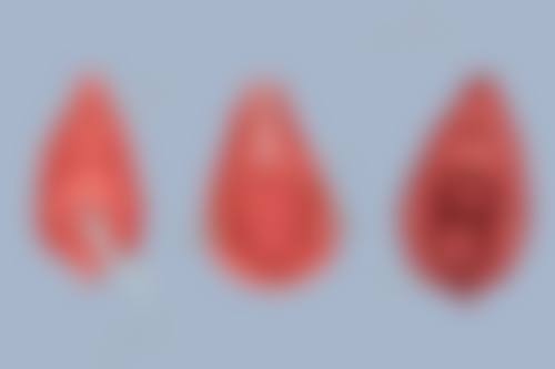 四、如何选择口碑好的吸脂机构