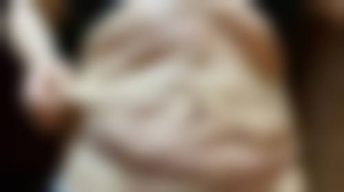 一、阴毛种植的基本概念