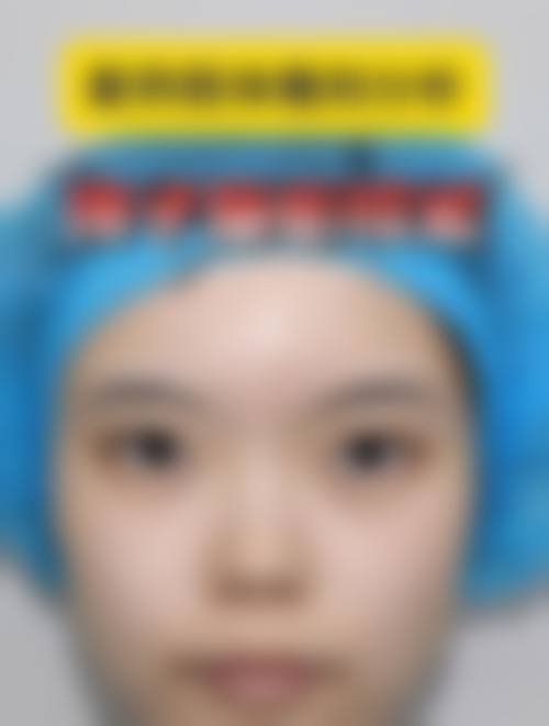 九、西安泰瑞德医疗美容门诊部真实的患者评价