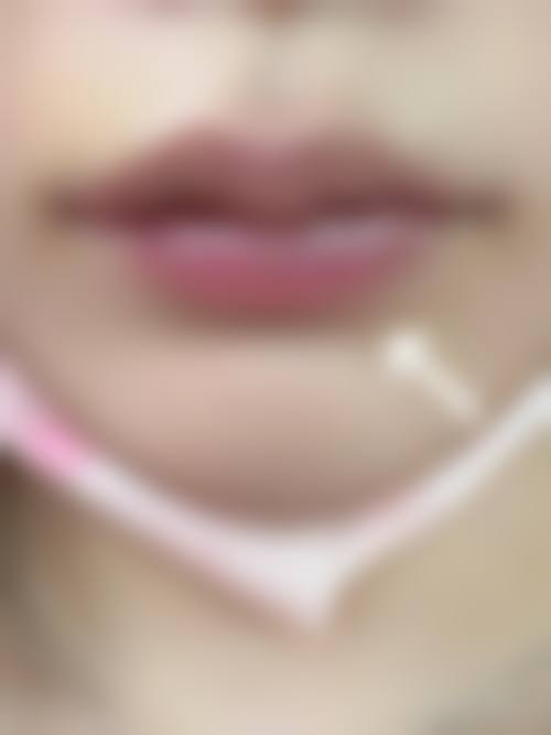 八、西安美妍之美整形医院真实的患者评价