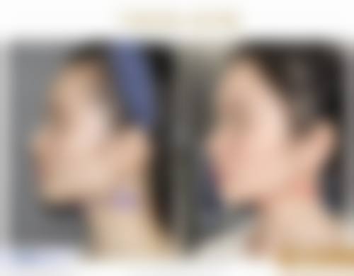 四、西安泰瑞德医疗美容门诊部特色项目