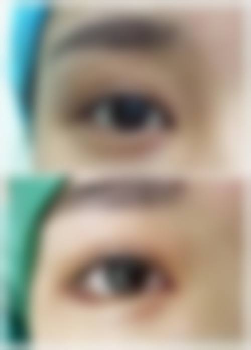 六、西安泰瑞德医疗美容门诊部价格表