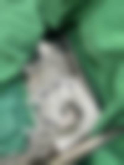 S女性医院李惠妍是否有失败案例？公开资料未明确，可查官方平台核实 