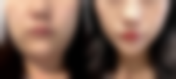 二、付海燕擅长项目