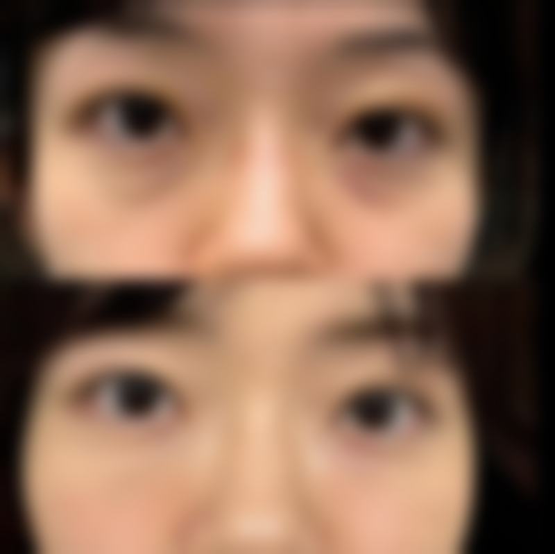 二、饮食注意事项