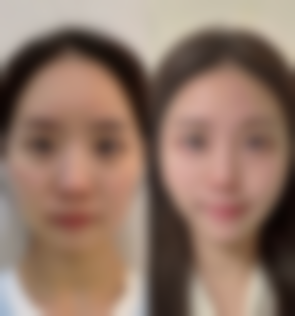 阴毛可以种植吗？了解毛囊移植技术、适用人群与风险，谨慎选择手术 