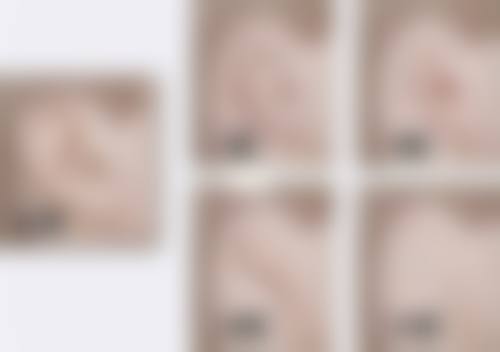 一、植入双眼皮的不同术式及维持时间