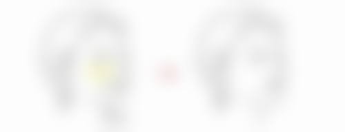 一、隆鼻后老了的总体情况