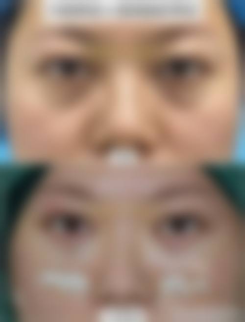 六、整形医院价格表