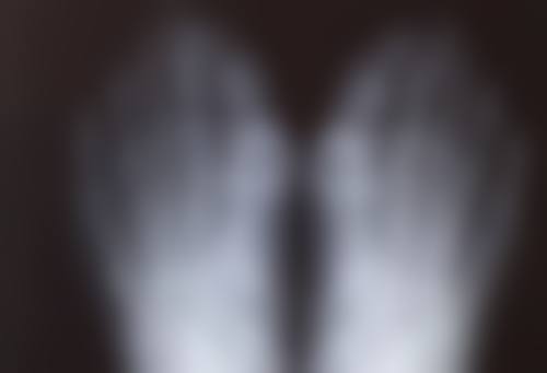 抽脂什么时候可以洗澡洗头？不同阶段清洁建议及注意事项一文说清！ 