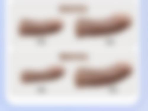 二、不同隆胸方式与哺乳的关系