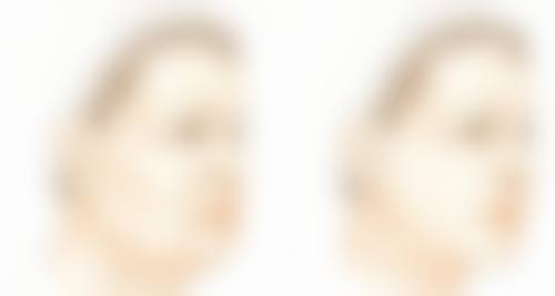 一、隆胸影响哺乳的关键因素