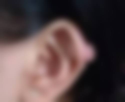 五、常见的治疗烫伤疤痕的方法