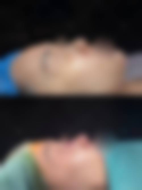 六、林哲秀真实的患者评价