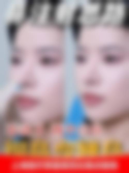 四、林哲秀收费价格表