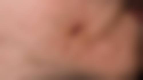 八、青云谱时向美容门诊部真实的患者评价